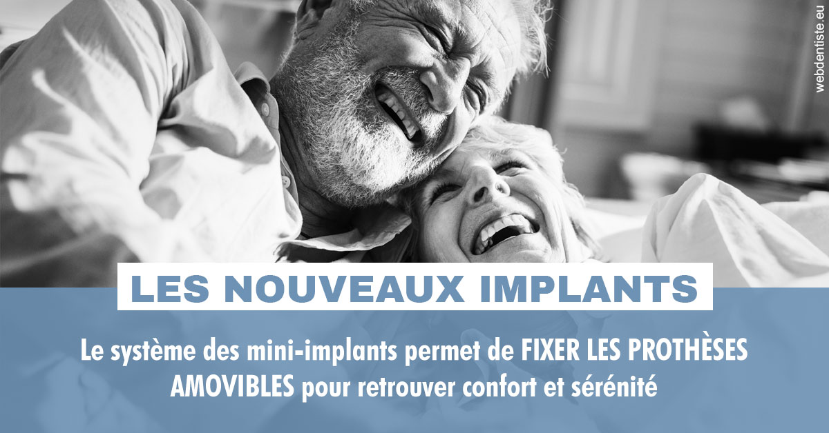 https://www.dr-paradisi.com/Les nouveaux implants 2