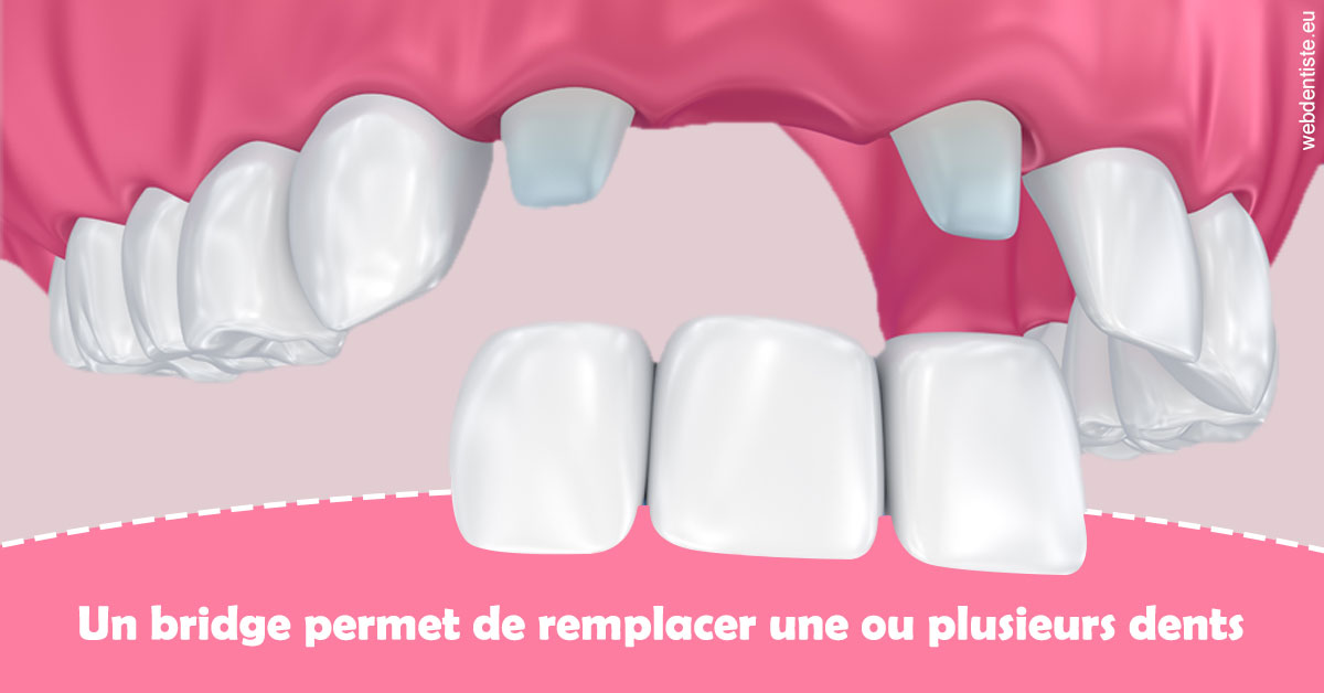 https://www.dr-paradisi.com/Bridge remplacer dents 2
