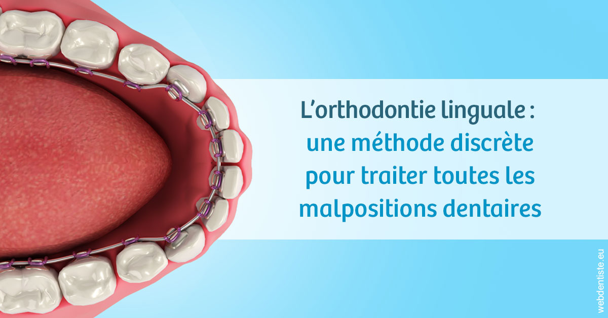 https://www.dr-paradisi.com/L'orthodontie linguale 1
