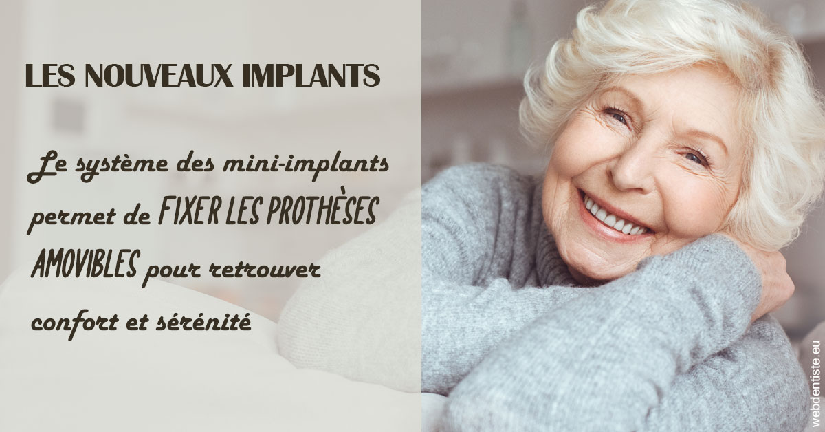 https://www.dr-paradisi.com/Les nouveaux implants 1