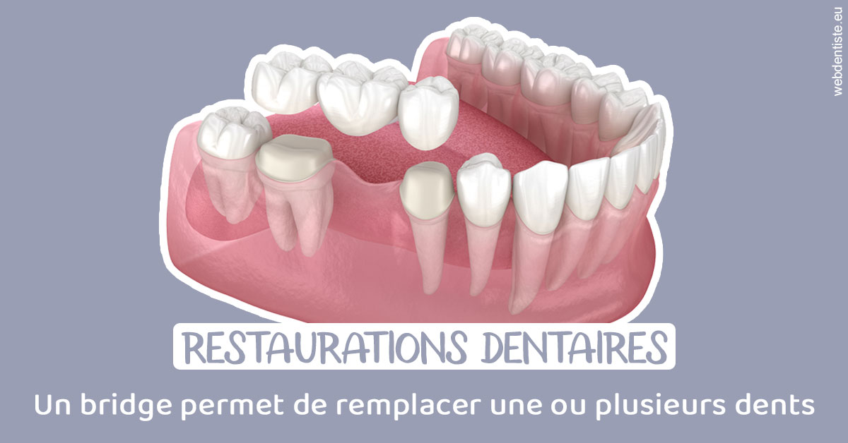 https://www.dr-paradisi.com/Bridge remplacer dents 1