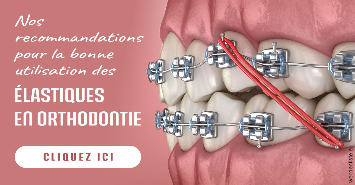 https://www.dr-paradisi.com/Elastiques orthodontie 2